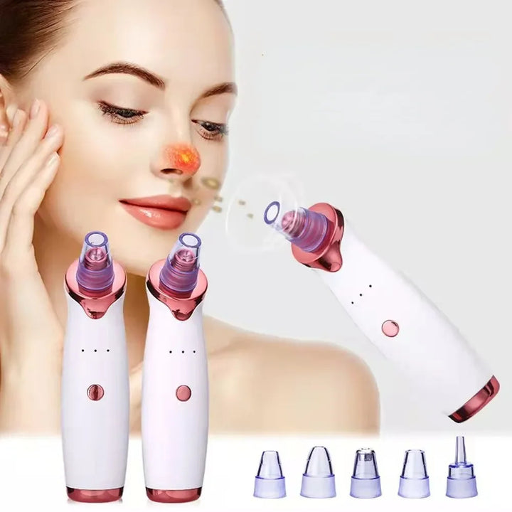 Aspirateur Électrique Anti-Points Noirs Rechargeable USB – Nettoyeur de Pores Visage