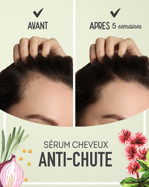 Sérum ANTI-CHUTE pour Stopper la Chute et Fortifier les Cheveux | UrbanK URBANK