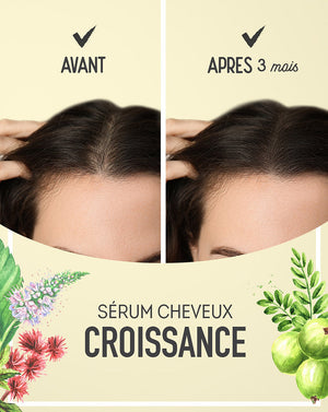 Sérum ANTI-CHUTE pour Stopper la Chute et Fortifier les Cheveux | UrbanK URBANK