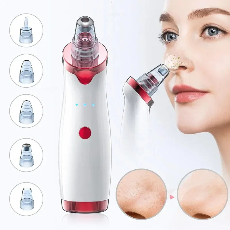 Aspirateur Électrique Anti-Points Noirs Rechargeable USB – Nettoyeur de Pores Visage