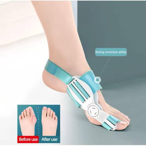 Correcteur d’Hallux Valgus FEETIFIX – Orthèse Réglable pour Alignement du Gros Orteil