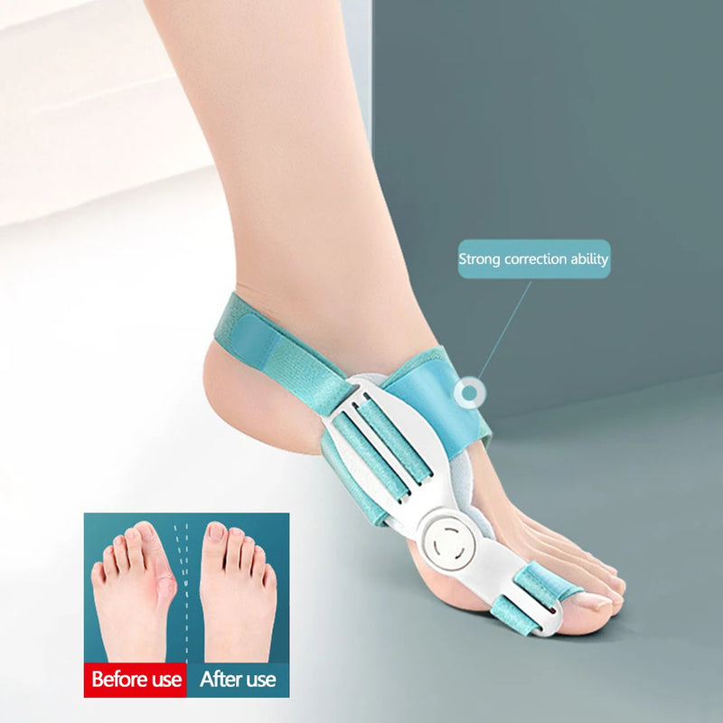 Correcteur d’Hallux Valgus FEETIFIX – Orthèse Réglable pour Alignement du Gros Orteil